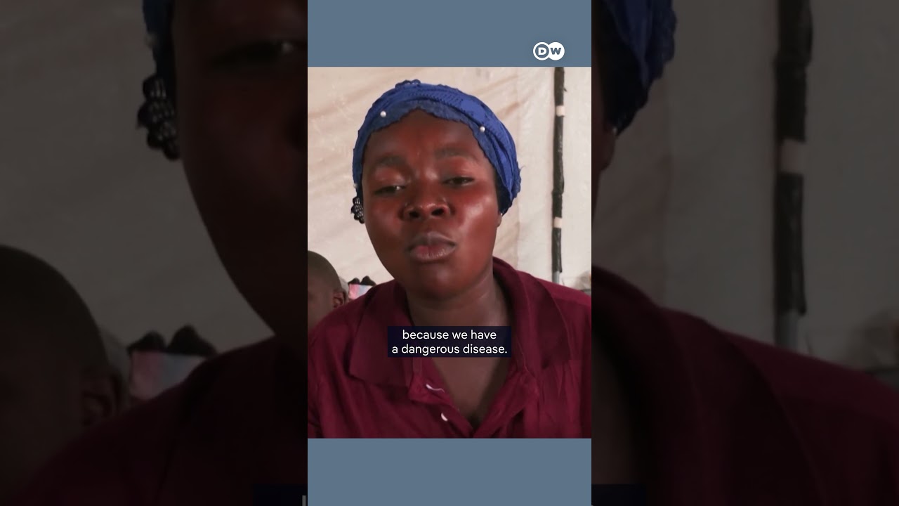 Thousands infected with a new Mpox virus variant in the Democratic Republic of the Congo | DW News