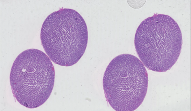 Scalable deep learning artificial intelligence histopathology slide analysis and validation