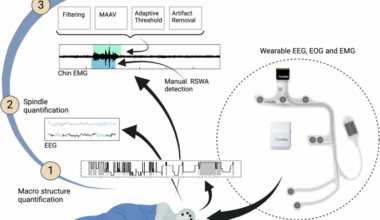 Semi automatic quantification of REM sleep without atonia in natural sleep environment