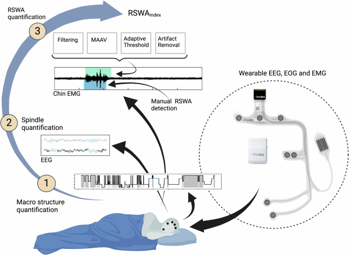 Semi automatic quantification of REM sleep without atonia in natural sleep environment