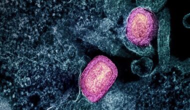 Mpox: Neue Variante breitet sich in Deutschland aus – Familie aus NRW in Quarantäne