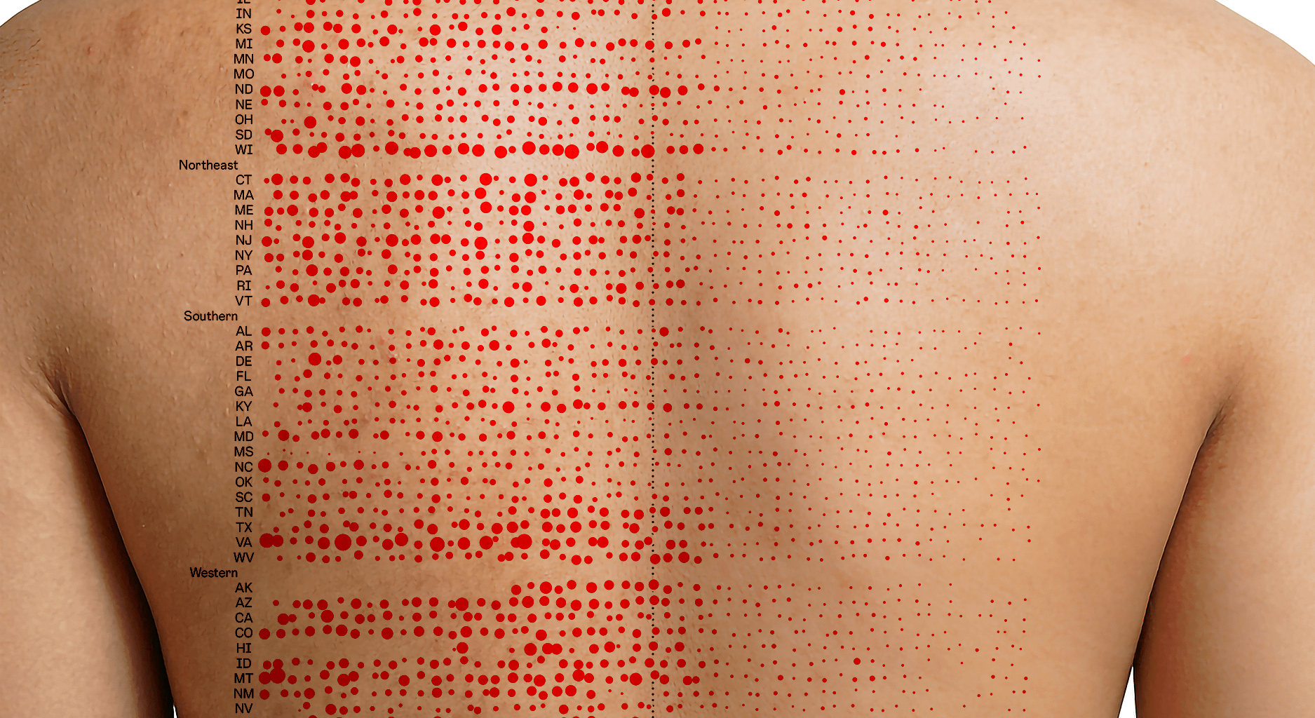 [OC] The Impact of the Measles Vaccine in the United States, 1938-1988