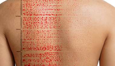 [OC] The Impact of the Measles Vaccine in the United States, 1938-1988