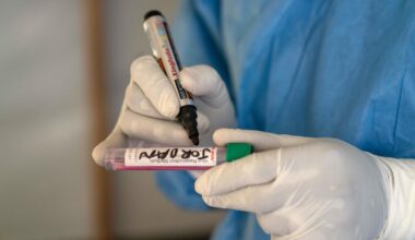 Schule in Nordrhein-Westfalen wegen Mpox vorsorglich geschlossen