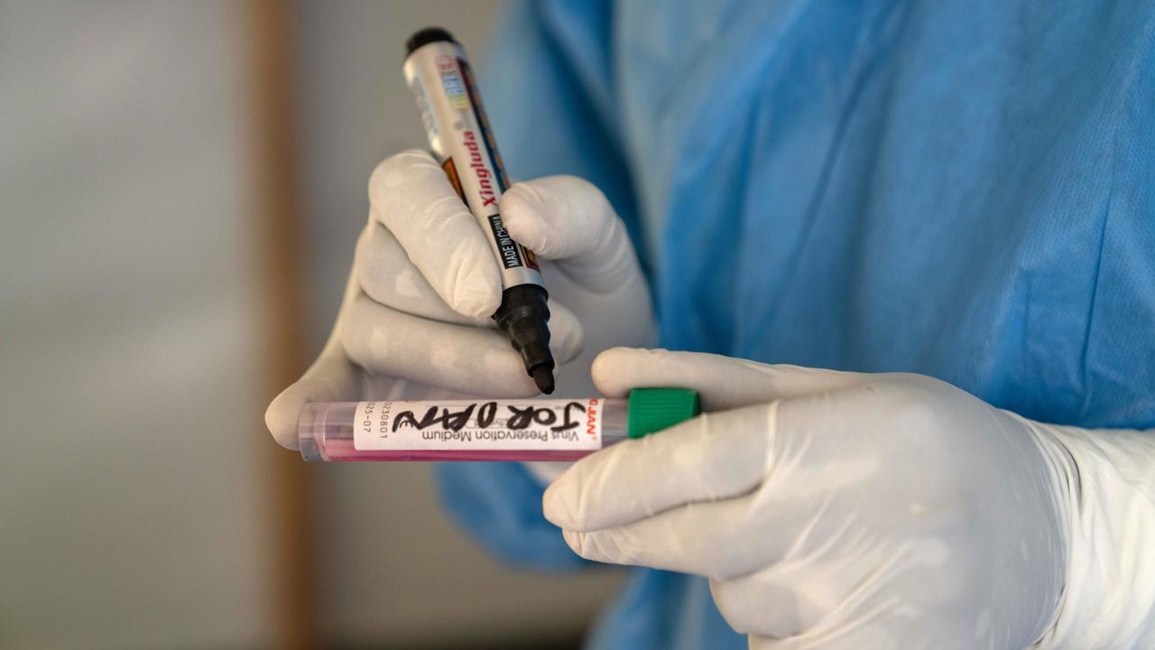 Schule in Nordrhein-Westfalen wegen Mpox vorsorglich geschlossen