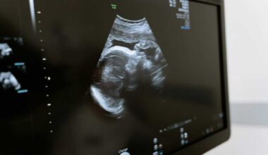 Ultrazvukové vyšetrenie dieťaťa v brušku vraj mení jeho DNA