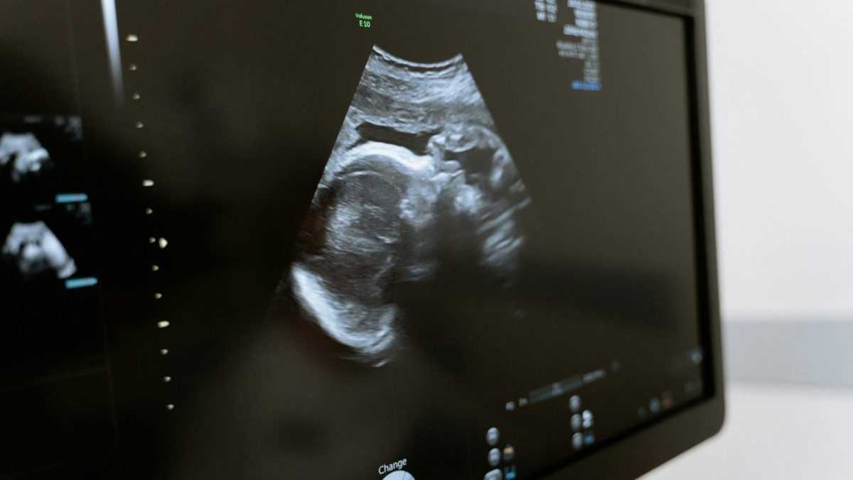 Ultrazvukové vyšetrenie dieťaťa v brušku vraj mení jeho DNA