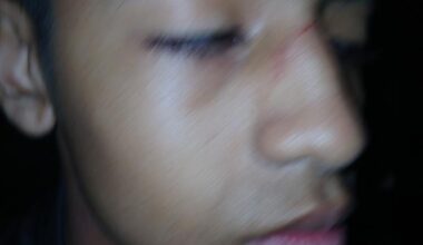 Aluno brasileiro sofre agressão e racismo em escola de Portugal