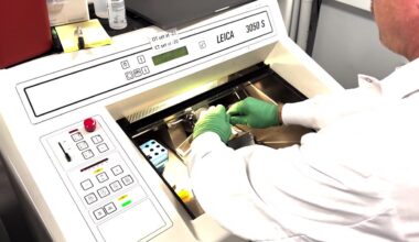 Seattle scientists make new brain cell discoveries