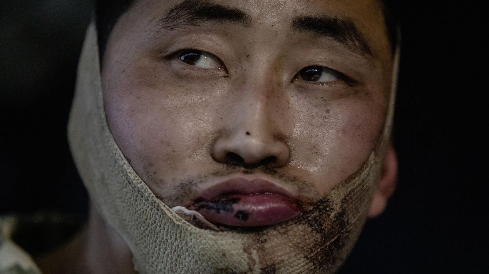North Korea Deployed 12,000 Troops To Kursk. A Third Are Casualties.