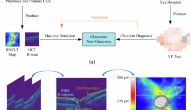 Equitable artificial intelligence for glaucoma screening with fair identity normalization