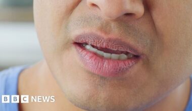 Cambridge study raises concern about regional accents stereotypes