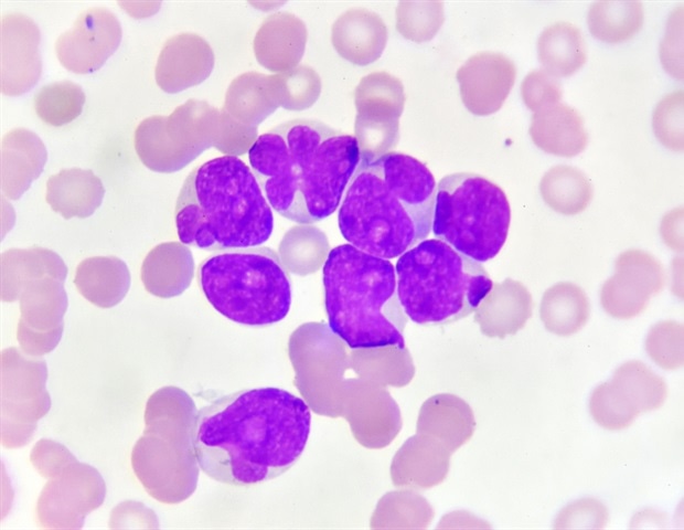 Immune environment found to influence success of leukemia immunotherapy
