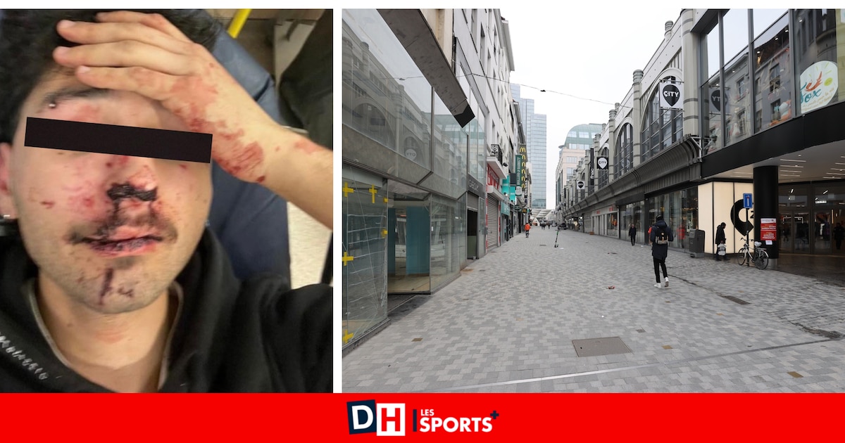 Matheo, 22 ans, roué de coups et laissé pour mort par cinq jeunes dans la rue Neuve : "Si le centre-ville n'est pas protégé, où pourrait-on l'être ?"