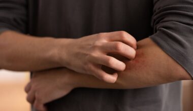 Itching Image