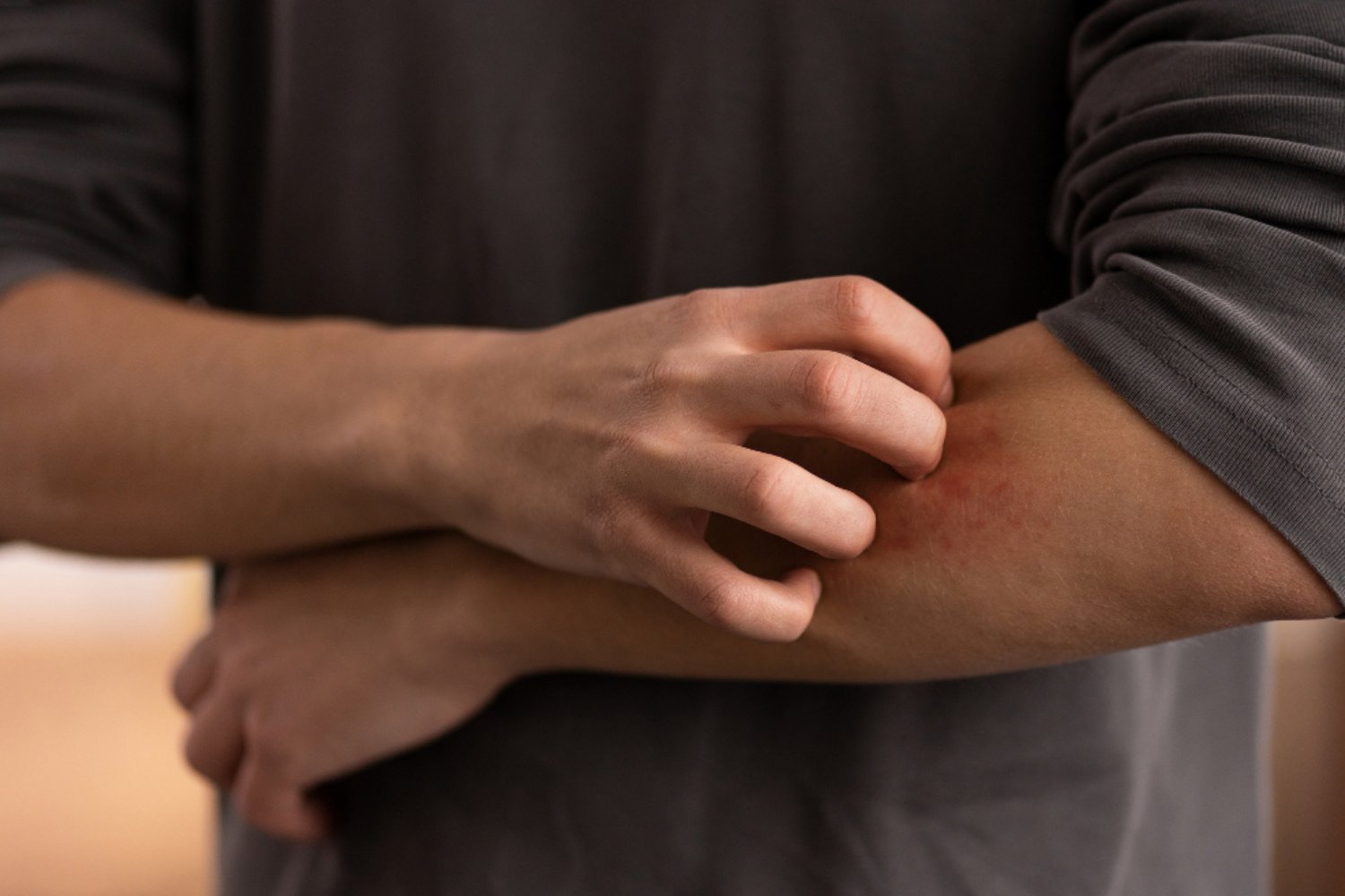 Itching Image
