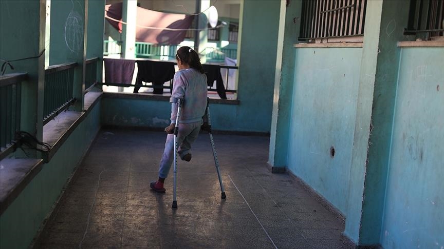4,500 amputations reported in Gaza amid Israeli war: Health official