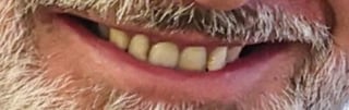 Guess the European Monarch By Their Teeth