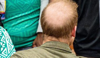 Shock pictures show Prince Harry's massive bald patch at Invictus Games finals
