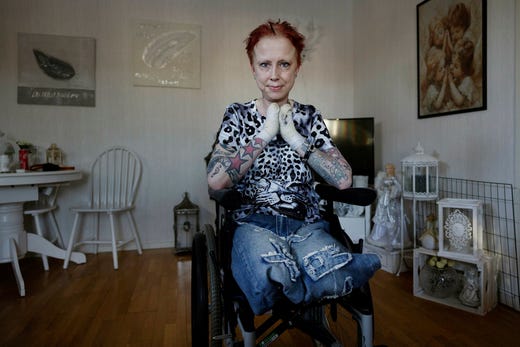 Linda Matthews Skoglund förlorade båda benen och alla fingrar efter insjuknande i sepsis.