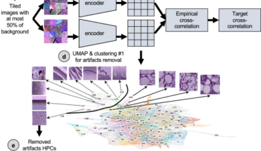 Self supervised artificial intelligence predicts poor outcome from primary cutaneous squamous cell carcinoma at diagnosis