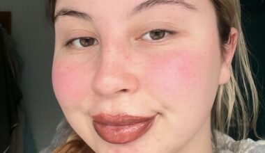 'Fillers turned me into a Monsters Inc character, I had to wear a mask in Asda'
