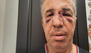 «Où va la France ?» : la colère d’un médecin après la condamnation de son agresseur à des travaux d’intérêt général