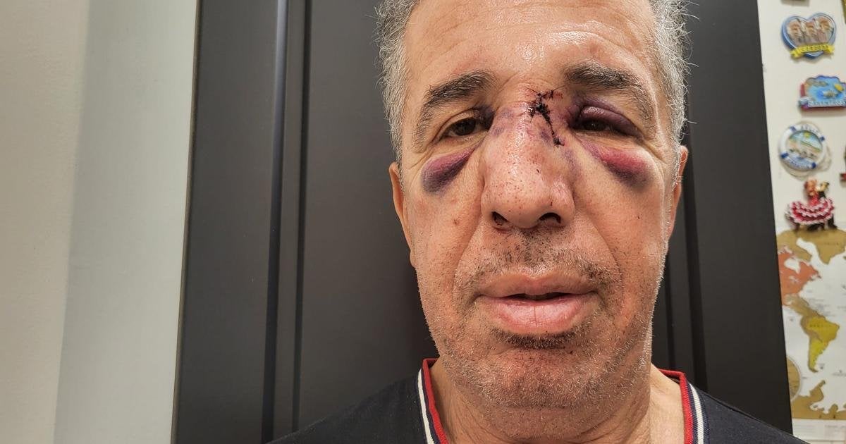 «Où va la France ?» : la colère d’un médecin après la condamnation de son agresseur à des travaux d’intérêt général