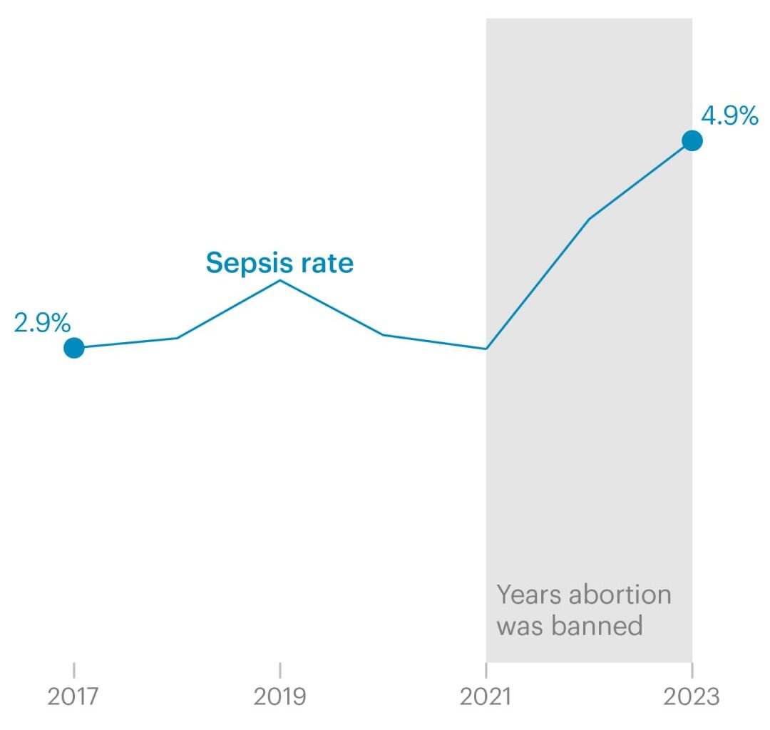 [OC] Texas' Sepsis Rates Spike After Abortion Ban (link in comments)