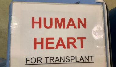 Latvijā cer beidzot pievienoties vērienīgam transplantācijas orgānu apmaiņas tīklam / Raksts