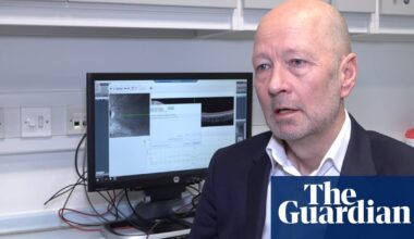 Doctors in London cure blindness in children with rare condition