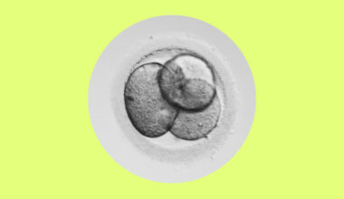 Opinion | Human Embryo Research: What Time Limit Should We Set?