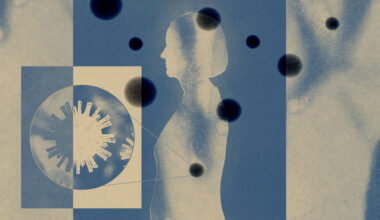 An illustration of the profile of a woman with virus shapes around her. This is about the link between Alzheimer's and viruses.