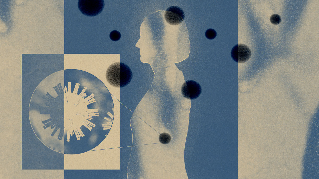 An illustration of the profile of a woman with virus shapes around her. This is about the link between Alzheimer's and viruses.