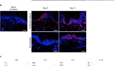 Development of a novel technology for long-term culture and live imaging of excised human tissue