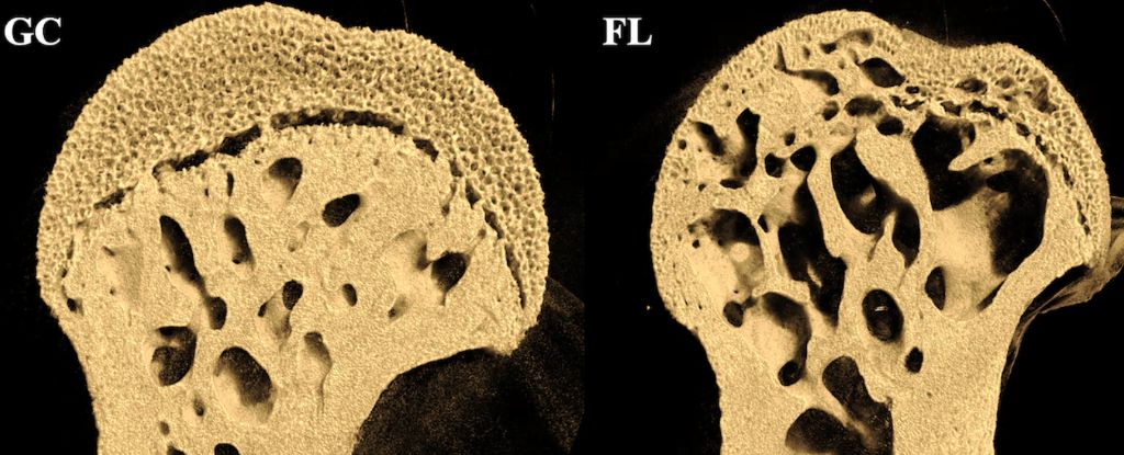 NASA Took Mice Into Space, And It Did Something Scary to Their Bones : ScienceAlert