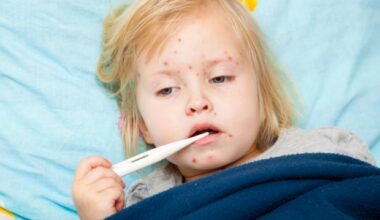 Report shows alarming measles resurgence in Europe and US