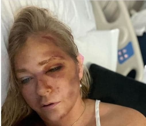 Prince Andrew’s accuser Virginia Giuffre given ‘four days to live’ after horror crash
