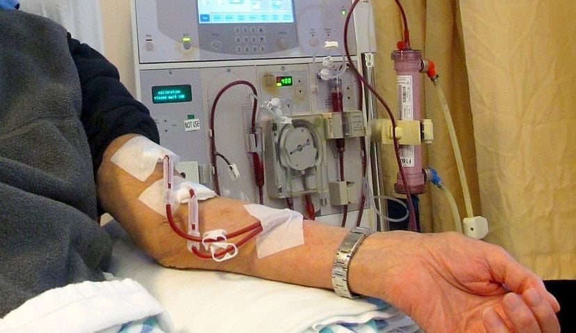 Patient receiving dialysis
