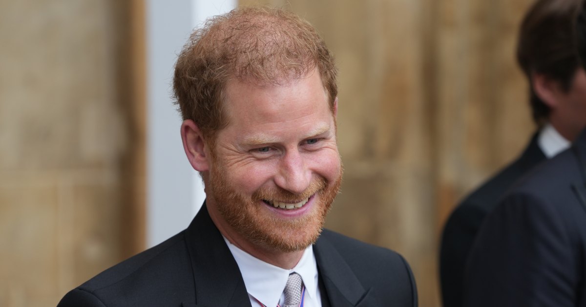 Prince Harry 'Takes Pride' in His Thinning Mane (EXCL)