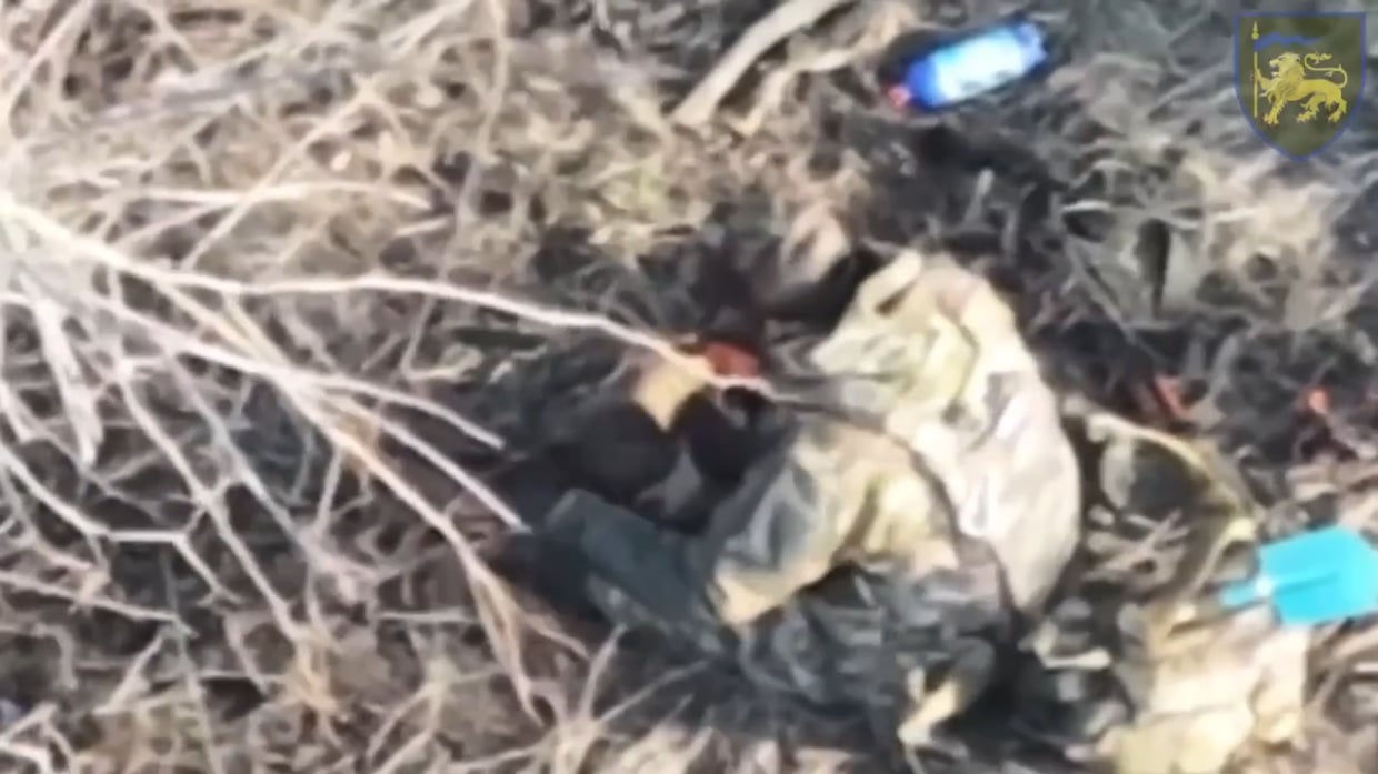 Russian hit by explosives resorted to cutting off his leg