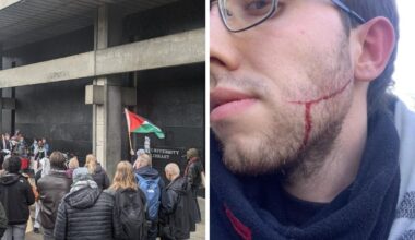 Pro-Palestine protester attacked with box-cutter in 'hate crime'