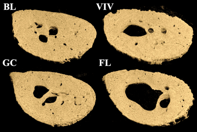 Astronaut Mice Femur Bone Marrow