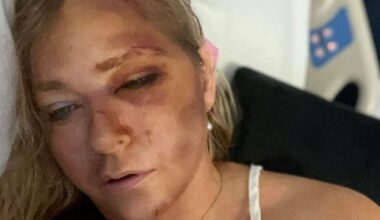 Prince Andrew accuser says she has days to live after car crash