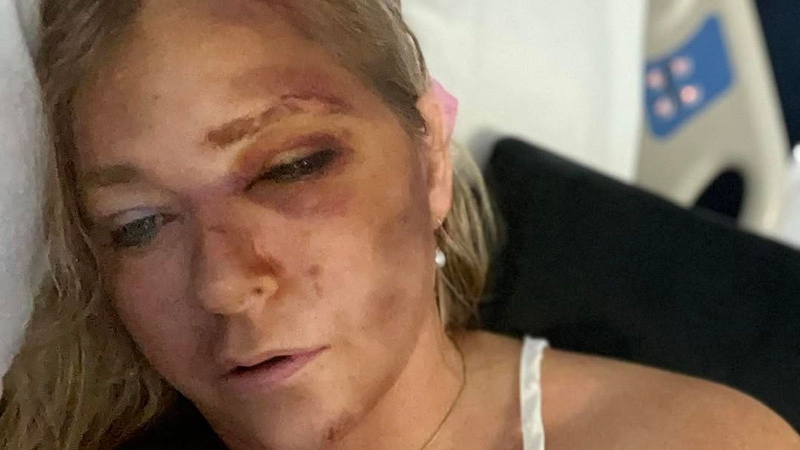 Prince Andrew accuser says she has days to live after car crash