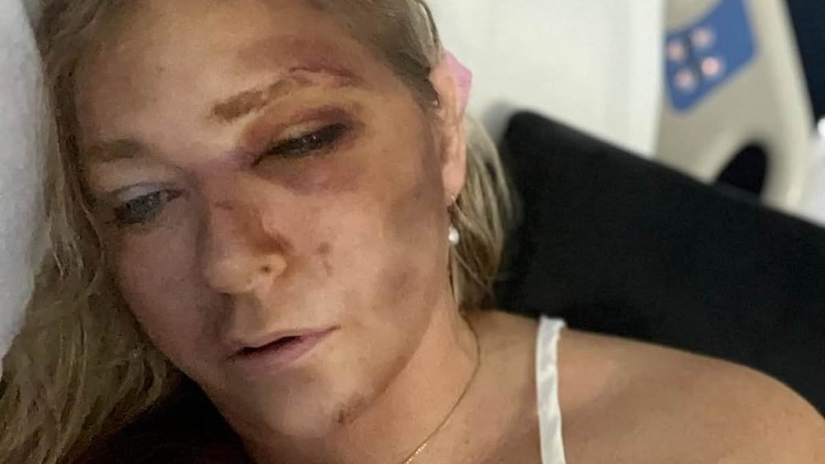 Bus driver in crash that left Virginia Giuffre claiming she has 'four days to live' gives HIS side of the story... and paints a VERY different picture to hers