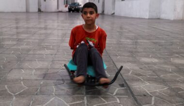 ‘How do I live like this?’ asks Gaza boy who lost arms in Israeli attack | Gaza News