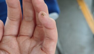 blinder Passagier der mir während der Fahrt nach Hause auf dem Bauch rumgekrabbelt ist. hab ihn/sie nach der Fahrt auf einer Wiese ausgesetzt