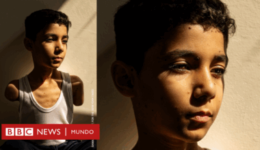 La historia detrás de la impactante imagen de un niño palestino mutilado que ganó el premio World Press Photo 2025