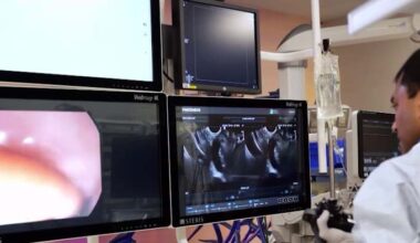 Orlando Health Digestive Institute uses AI to help find tumors in clinical study
